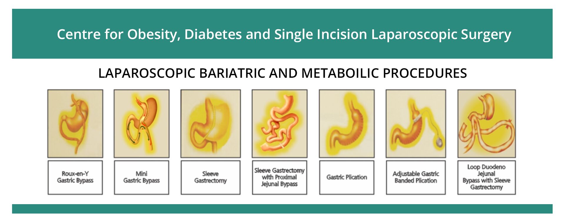 laparoscopic surgery